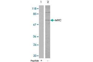 Western blot analysis of extracts from ovary cancer cells , using MYC polyclonal antibody  . (c-MYC 抗体)