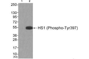 Western blot analysis of extracts from JK cells (Lane 2), using HS1 (Phospho-Tyr397) Antibody. (HCLS1 抗体  (pTyr397))