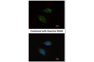 ICC/IF Image Immunofluorescence analysis of methanol-fixed HeLa, using MMP9, antibody at 1:200 dilution. (MMP 9 抗体)