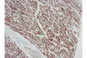 Image no. 3 for anti-Actin, Alpha, Cardiac Muscle 1 (ACTC1) antibody (ABIN959519) (ACTC1 抗体)