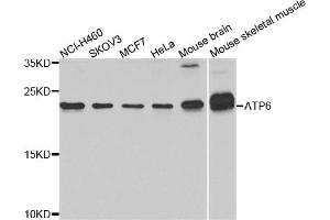 Western blot analysis of extracts of various cell lines, using ATP6 antibody (ABIN5975827) at 1/1000 dilution. (MT-ATP6 抗体)