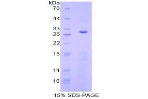 SDS-PAGE analysis of Mouse SGK3 Protein. (SGK3 蛋白)