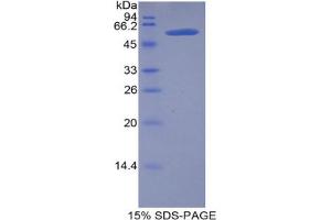 SDS-PAGE analysis of Mouse Lipase, Hepatic Protein. (LIPC 蛋白)