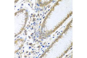 Immunohistochemistry of paraffin-embedded human stomach using EIF4E antibody at dilution of 1:100 (40x lens). (EIF4E 抗体)
