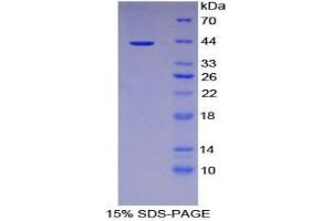 SDS-PAGE analysis of Human IL12Rb2 Protein. (IL12RB2 蛋白)