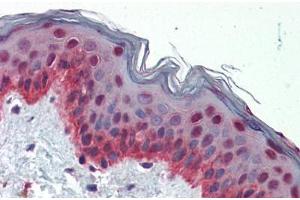 Human Skin (formalin-fixed, paraffin-embedded) stained with NFIX antibody ABIN462183 followed by biotinylated goat anti-rabbit IgG secondary antibody ABIN481713, alkaline phosphatase-streptavidin and chromogen. (NFIX 抗体  (AA 181-230))