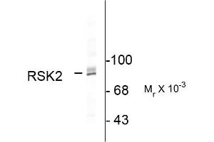 Western blots of HeLa lysate showing specific immunolabeling of the ~90k RSK2 protein. (RPS6KA2 抗体  (C-Term))