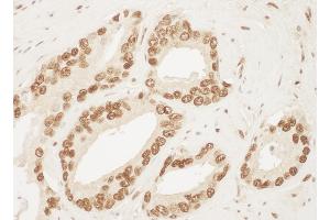 Immunohistochemistry (IHC) image for anti-X-Ray Repair Complementing Defective Repair in Chinese Hamster Cells 6 (XRCC6) (AA 559-609) antibody (ABIN7454846)