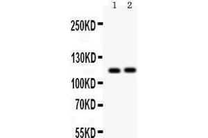 Anti- ATP2A2 antibody, Western blotting All lanes: Anti ATP2A2  at 0. (ATP2A2 抗体  (N-Term))