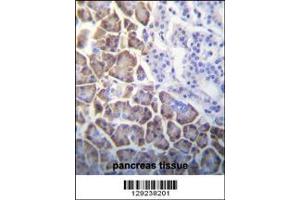 Immunohistochemistry (IHC) image for anti-Inhibitor of DNA Binding 1, Dominant Negative Helix-Loop-Helix Protein (ID1) (AA 66-93) antibody (ABIN3031300)