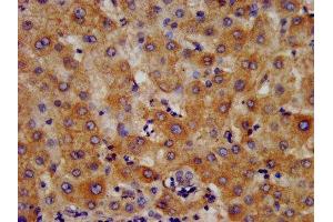IHC image of ABIN7156004 diluted at 1:400 and staining in paraffin-embedded human liver tissue performed on a Leica BondTM system.