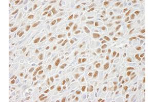 Immunohistochemistry (IHC) image for anti-Structural Maintenance of Chromosomes 1A (SMC1A) (C-Term) antibody (ABIN7448802) (SMC1A 抗体  (C-Term))