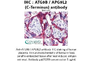 Image no. 1 for anti-Autophagy Related 9B (ATG9B) (C-Term) antibody (ABIN1732024) (ATG9B 抗体  (C-Term))