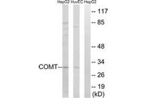 Western blot analysis of extracts from HuvEc/HepG2 cells, using COMT Antibody. (COMT 抗体  (AA 61-110))
