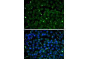 Immunofluorescence analysis of U2OS cells using GPI antibody (ABIN6292114). (GPI 抗体)