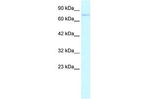WB Suggested Anti-ZNF336 Antibody Titration: 0. (ZNF336 抗体  (N-Term))