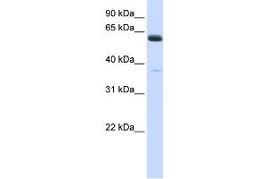 WB Suggested Anti-ALG6 Antibody Titration:  0. (ALG6 抗体  (N-Term))