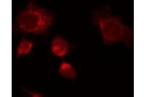 ABIN6276992 staining HeLa by IF/ICC.