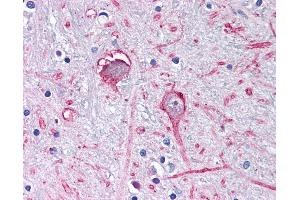 Anti-GABRA3 antibody IHC of human brain, globus pallidus. (GABRA3 抗体  (C-Term))