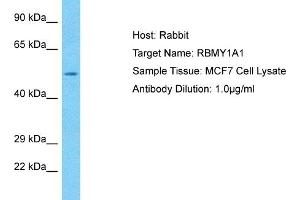 Host: Rabbit Target Name: RBMY1A1 Sample Tissue: Human MCF7 Whole Cell Antibody Dilution: 1ug/ml (RBMY1A1 抗体  (C-Term))