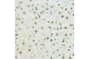 Immunohistochemistry of paraffin-embedded rat liver using Phospho-Histone H3-T45 antibody (ABIN7267692) at dilution of 1:100 (40x lens).