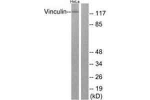 Western blot analysis of extracts from HeLa cells, treated with forskolin 40nM 30', using Vinculin (Ab-821) Antibody. (Vinculin 抗体  (AA 786-835))