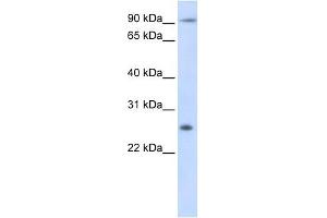 Tetraspanin 31 antibody used at 1 ug/ml to detect target protein. (TSPAN31 抗体  (Middle Region))