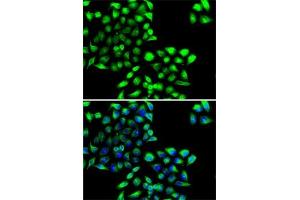 Immunofluorescence analysis of MCF7 cells using COPS6 antibody (ABIN6130710, ABIN6138885, ABIN6138886 and ABIN6222868). (COPS6 抗体  (AA 58-327))