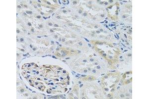 Immunohistochemistry of paraffin-embedded Rat kidney using SLC29A1 Polyclonal Antibody at dilution of 1:100 (40x lens). (SLC29A1 抗体)