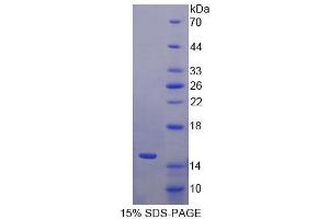 SDS-PAGE analysis of Human S100A15 Protein. (S100A7A 蛋白)