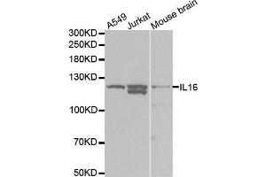 Western blot analysis of extracts of various cell lines, using IL16 antibody. (IL16 抗体  (AA 1-305))