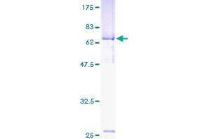 Cat Eye Syndrome Chromosome Region, Candidate 5 (CECR5) (AA 24-423) protein (GST tag)