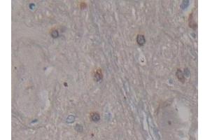 DAB staining on IHC-P; Samples: Rat Spinal cord Tissue (CDNF 抗体  (AA 20-183))