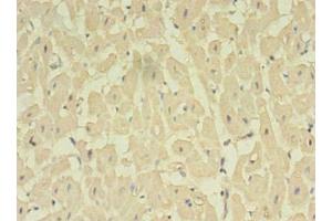 Immunohistochemistry of paraffin-embedded human heart tissue using ABIN7161713 at dilution of 1:100 (NOSTRIN 抗体  (AA 1-322))