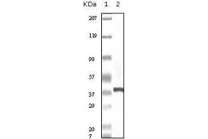 Western Blot showing calcyclin antibody used against truncated calcyclin recombinant protein. (S100A6 抗体)