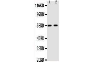Anti-Aromatase antibody, Western blotting Lane 1: Human Placenta Tissue Lysate Lane 2: Human Placenta Tissue Lysate