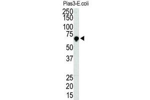 Western Blotting (WB) image for anti-Protein Inhibitor of Activated STAT, 3 (PIAS3) antibody (ABIN2996753) (PIAS3 抗体)