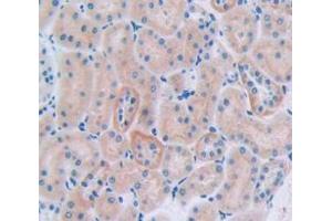 IHC-P analysis of Rat Tissue, with DAB staining. (CUBN 抗体  (AA 3157-3274))