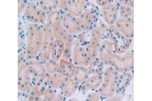 IHC-P analysis of Rat Tissue, with DAB staining. (CUBN 抗体  (AA 3157-3274))