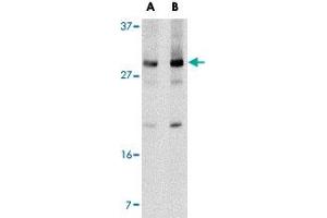 Western blot analysis of Klra2 in mouse spleen tissue lysate with Klra2 polyclonal antibody  at (A) 0. (Klra2 抗体  (C-Term))