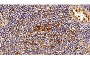 Immunohistochemistry (IHC) image for anti-Galectin 3 (LGALS3) (AA 1-250) antibody (ABIN7431560)