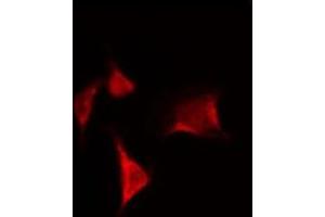 ABIN6269252 staining Hela by IF/ICC. (MTOR 抗体)