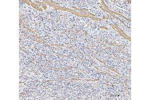 IHC analysis of MT-ND5 using anti-MT-ND5 antibody (ABIN7600145).
