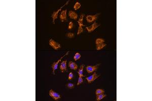 Immunofluorescence analysis of U2OS cells using TRH Rabbit pAb (ABIN7270826) at dilution of 1:100. (TRH 抗体  (AA 100-200))