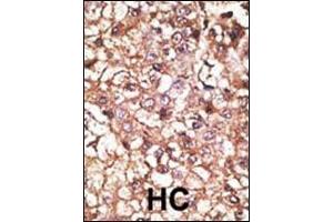 Immunohistochemistry (Paraffin-embedded Sections) (IHC (p)) image for anti-STIP1 Homology and U-Box Containing Protein 1 (STUB1) (AA 203-231), (C-Term) antibody (ABIN390386)