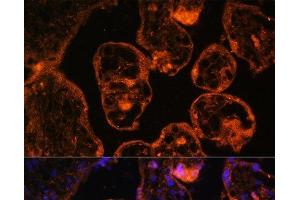 Immunofluorescence analysis of Human placenta cells using LDB3 Polyclonal Antibody at dilution of 1:100. (LIM Domain Binding 3 Protein 抗体)