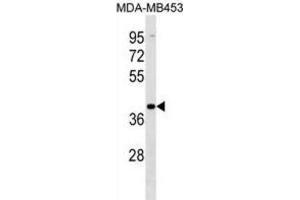 Western Blotting (WB) image for anti-Vomeronasal 1 Receptor 2 (VN1R2) antibody (ABIN3000165) (VN1R2 抗体)