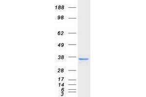 Western Blotting (WB) image for Nudix (Nucleoside Diphosphate Linked Moiety X)-Type Motif 18 (NUDT18) protein (Myc-DYKDDDDK Tag) (ABIN2727755)