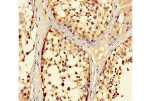 Immunohistochemistry of paraffin-embedded human testis tissue using ABIN7151262 at dilution of 1:100 (TRIM36 抗体  (AA 70-280))