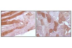 Immunohistochemical analysis of paraffin-embedded human skeletal muscle tissue showing cytoplasmic localization using anti-Myoglobin antibody with DAB staining. (Myoglobin 抗体)